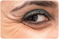area-botox-section