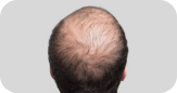 HAIR CONDITIONS