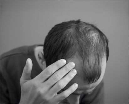 Hair Loss