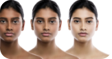 Tanning / Pigmentation