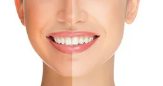 Antiaging Treatment